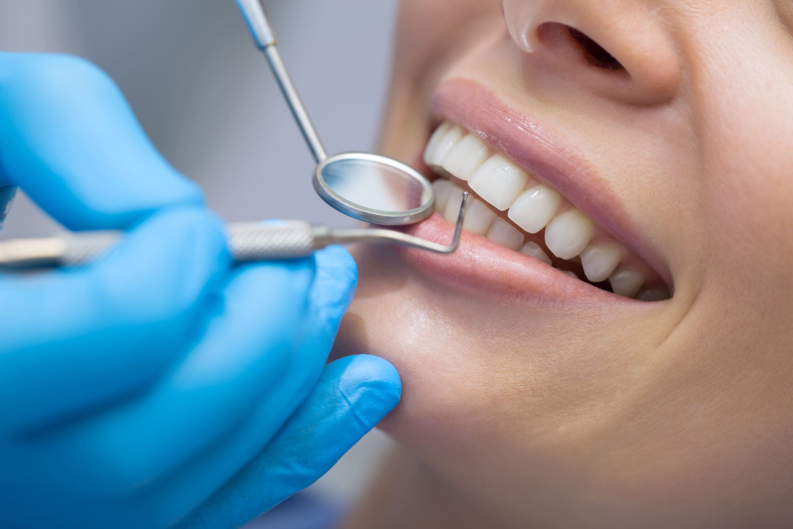 Teeth checkup
