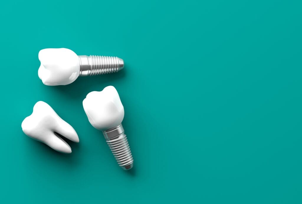 Tooth,And,Dental,Implants,Isolated,On,Green,Background.,3d,Illustration