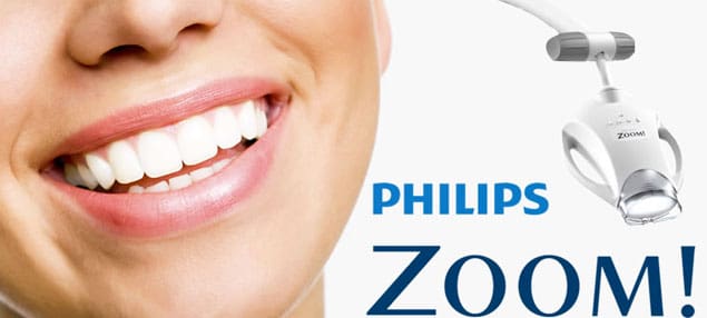 Philips zoom teeth whitening in Auckland.